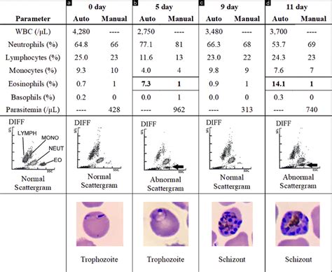 how is the white blood count analyzed in a laboratory|how to read white blood cell count.